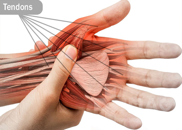 درمان آسیب تاندون انگشتان