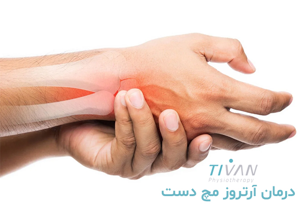 درمان آرتروز مچ دست