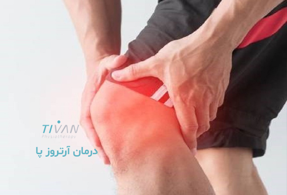 درمان آرتروز پا