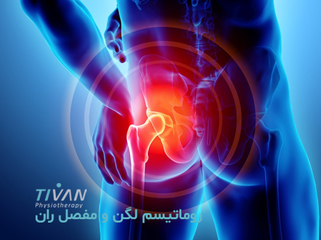 درمان روماتیسم لگن و مفصل ران