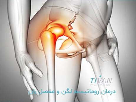 درمان روماتیسم لگن و مفصل ران