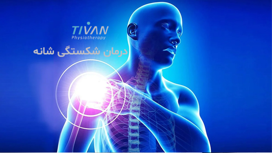 درمان شکستگی شانه