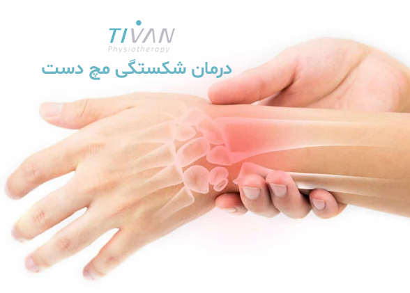 درمان شکستگی مچ دست