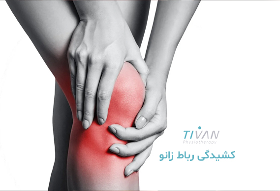 درمان کشیدگی رباط زانو