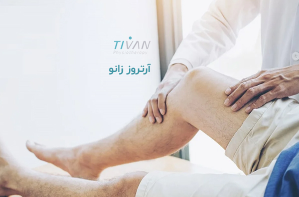 درمان آرتروز زانو