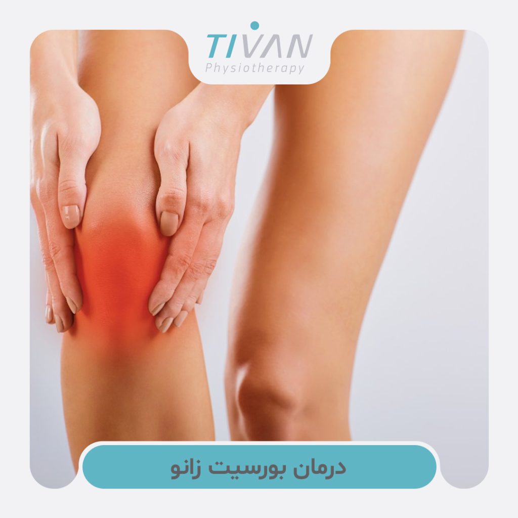 درمان بورسیت زانو