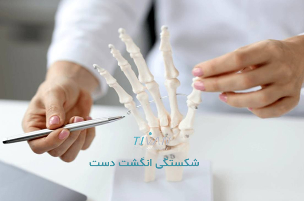 درمان شکستگی انگشت دست