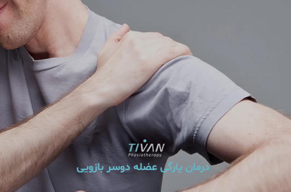 درمان پارگی عضله دوسر بازویی