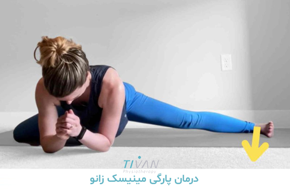 درمان پارگی مینیسک زانو