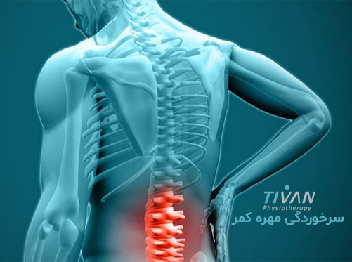 درمان سرخوردگی مهره‌ کمر