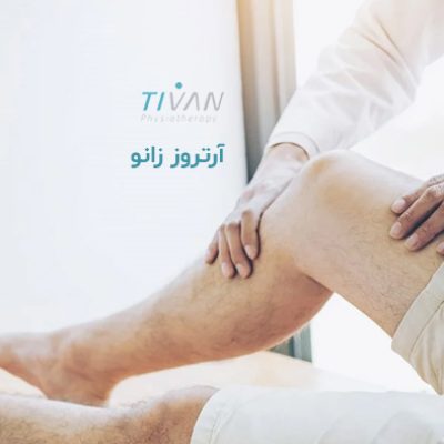 درمان آرتروز زانو