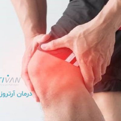 درمان آرتروز پا
