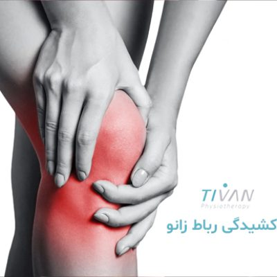 درمان کشیدگی رباط زانو