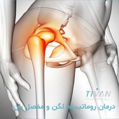 درمان روماتیسم لگن و مفصل ران