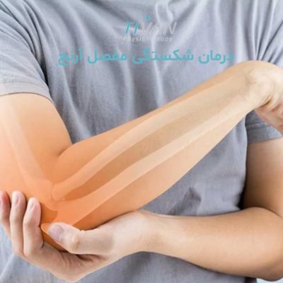 درمان شکستگی مفصل آرنج