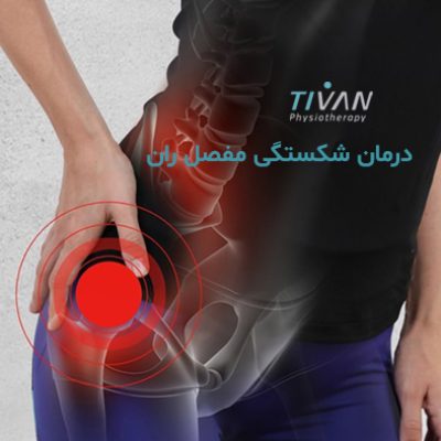 درمان شکستگی مفصل ران
