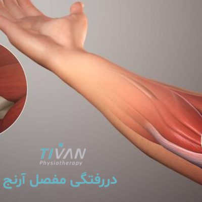 دررفتگی مفصل آرنج