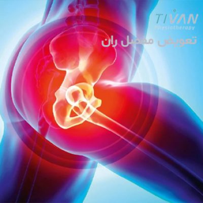 درمان تعویض مفصل ران