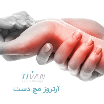 درمان آرتروز مچ دست