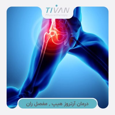 درمان آرتروز هیپ , مفصل ران