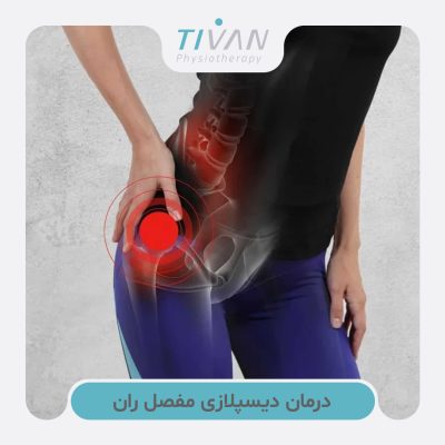 درمان دیسپلازی مفصل ران