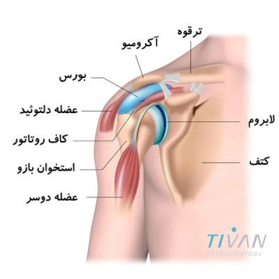 درمان شانه منجمد