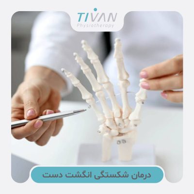 درمان شکستگی انگشت دست