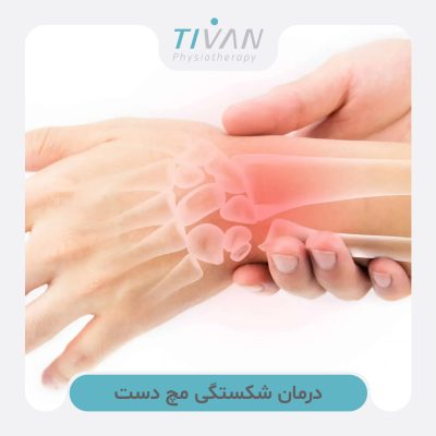 درمان شکستگی مچ دست