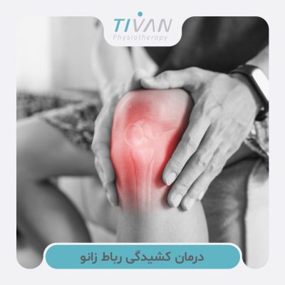درمان کشیدگی رباط زانو